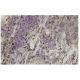 MTHFD2 Antibody (243.1) - Immunohistochemistry - Image 36143 