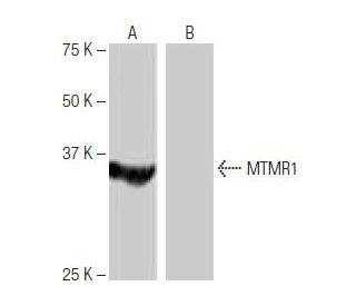 MTMR1 Antibody (1B9) - Western Blotting - Image 65009