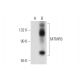 MTMR3 Antibody (C-4) - Western Blotting - Image 344122