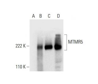 MTMR5 Antibody (B-9) - Western Blotting - Image 297597 