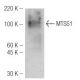 MTSS1 Antibody (M7-P3A7) - Western Blotting - Image 47836 