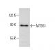 MTSS1 Antibody (SS-3) - Western Blotting - Image 48585 