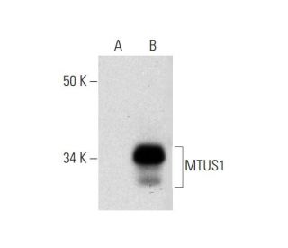 MTUS1 Antibody (E-8) - Western Blotting - Image 292102