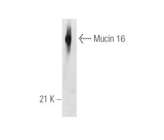 Mucin 16/MUC16 Antibody (X306) - Western Blotting - Image 14553