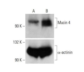 Mucin 4/MUC4 Antibody (1G8) - Western Blotting - Image 321873