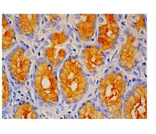 Mucin 5AC/MUC5AC Antibody (2-11M1) - Immunohistochemistry - Image 315760 