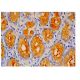 Mucin 5AC/MUC5AC Antibody (2-11M1) - Immunohistochemistry - Image 315760 