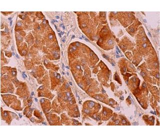 Mucin 5AC/MUC5AC Antibody (2Q445) - Immunohistochemistry - Image 369587 