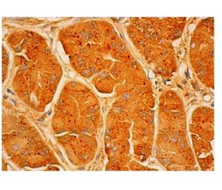Mucin 5AC/MUC5AC Antibody (45M1) - Immunohistochemistry - Image 313898 