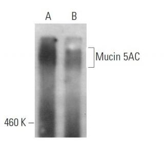 Mucin 5AC/MUC5AC Antibody (A-5) - Western Blotting - Image 379441 