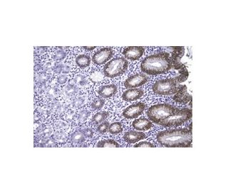 Mucin 5AC/MUC5AC Antibody (CLH2) - Immunohistochemistry - Image 12391 