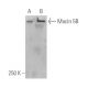 Mucin 5B/MUC5B Antibody (5B#19-2E) - Western Blotting - Image 5301