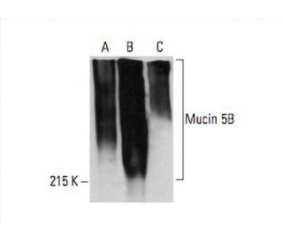 Mucin 5B/MUC5B Antibody (A-3) - Western Blotting - Image 392583 