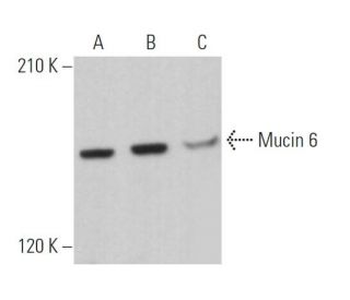 Mucin 6/MUC6 Antibody (0.N.459) - Western Blotting - Image 363829