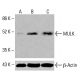 MULK抗体(C-7):sc-398943。Western blot分析未处理(A)及化学处理(B, C)K-562细胞全细胞裂解液中MULK表达。β-肌动蛋白(C4):sc-47778作为加载对照。检测试剂: m-IgG Fc BP-HRP:sc-525409。 MULK Antibody (C-7) - Western Blotting - Image 415563