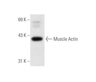 Muscle Actin Antibody (4i346) - Western Blotting - Image 61983 