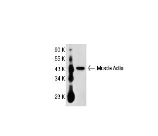 Muscle Actin Antibody (5G2) - Western Blotting - Image 21178 