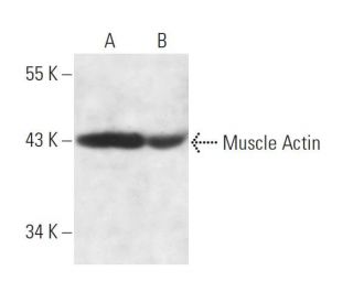 Muscle Actin Antibody (HHF35) - Western Blotting - Image 14069 