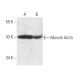 Muscle Actin Antibody (HHF35) - Western Blotting - Image 14069 