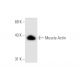 Muscle Actin Antibody (HHF35) - Western Blotting - Image 61986