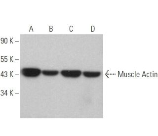 Muscle Actin Antibody (HUC1-1) - Western Blotting - Image 359331 