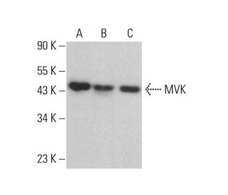 MVK Antibody (D-3) - Western Blotting - Image 378040 