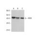 MVK Antibody (D-3) - Western Blotting - Image 378040 