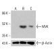 MVK 抗体 (D-3):sc-390669。通过蛋白质印迹分析未处理的 HCT-116(A)、经化学处理的 HCT-116(B)和 HeLa(C)完整细胞裂解物中的 MVK 表达 。β-肌动蛋白(C4):sc-47778用作加载对照。使用的检测试剂:m-IgG Fc BP-HRP:sc-525409。 MVK Antibody (D-3) - Western Blotting - Image 415120