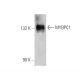 MYBPC1 Antibody (E-6) - Western Blotting - Image 346515