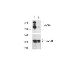 MyD88 siRNA (m): sc-35987. Western blot analysis of MyD88 expression in non-transfected control (A) and MyD88 siRNA transf 