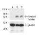 Myeloid Marker Antibody (1400-10) - Western Blotting - Image 411897