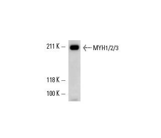 MYH1/2/3 Antibody (N3.36) - Western Blotting - Image 13731 
