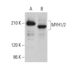 MYH1/2 Antibody (A4.1025) - Western Blotting - Image 379810 