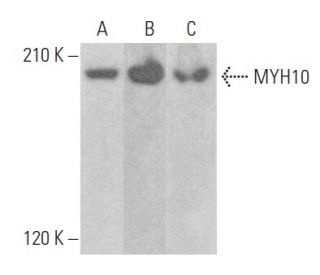 MYH10 Antibody (A-5) - Western Blotting - Image 355220