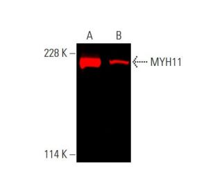 MYH11 Antibody (I-5) - Western Blotting - Image 381614 