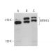 MYH15 Antibody (C-8) - Western Blotting - Image 379148
