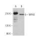 Myosin-2/MYH2 Antibody (6D596) - Western Blotting - Image 379866 