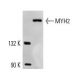 Myosin-2/MYH2 Antibody (A4.1519) - Western Blotting - Image 13733