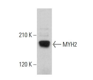 Myosin-2/MYH2 Antibody (A4.1519) - Western Blotting - Image 379867 