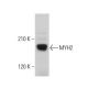 Myosin-2/MYH2 Antibody (A4.1519) - Western Blotting - Image 379867 