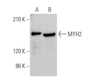 Myosin-2/MYH2 Antibody (A4.74) - Western Blotting - Image 374434 