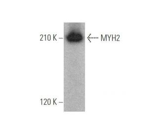 Myosin-2/MYH2 Antibody (N2.261) - Western Blotting - Image 352416 