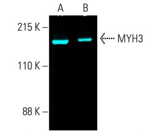 MYH3 Antibody (F1.652) - Western Blotting - Image 402180 