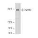 MYH7 Antibody (6D592) - Western Blotting - Image 17608 