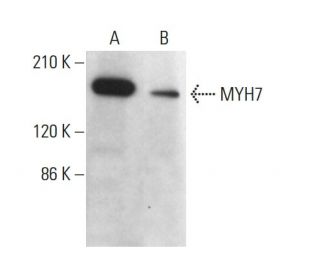MYH7 Antibody (A4.951) - Western Blotting - Image 380634 