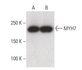 MYH7 Antibody (A4.840) - Western Blotting - Image 400355