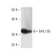 MYL12B Antibody (29) - Western Blotting - Image 136766