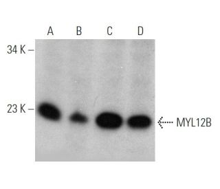MYL12B Antibody (29) - Western Blotting - Image 370737 