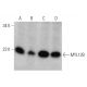 MYL12B Antibody (29) - Western Blotting - Image 370737 