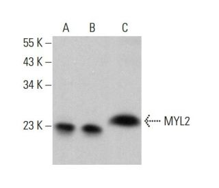 MYL2 Antibody (7C9) - Western Blotting - Image 376415 